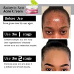 EASYGLOWING Salicylic Acid Acne Cream 50g - Image 3